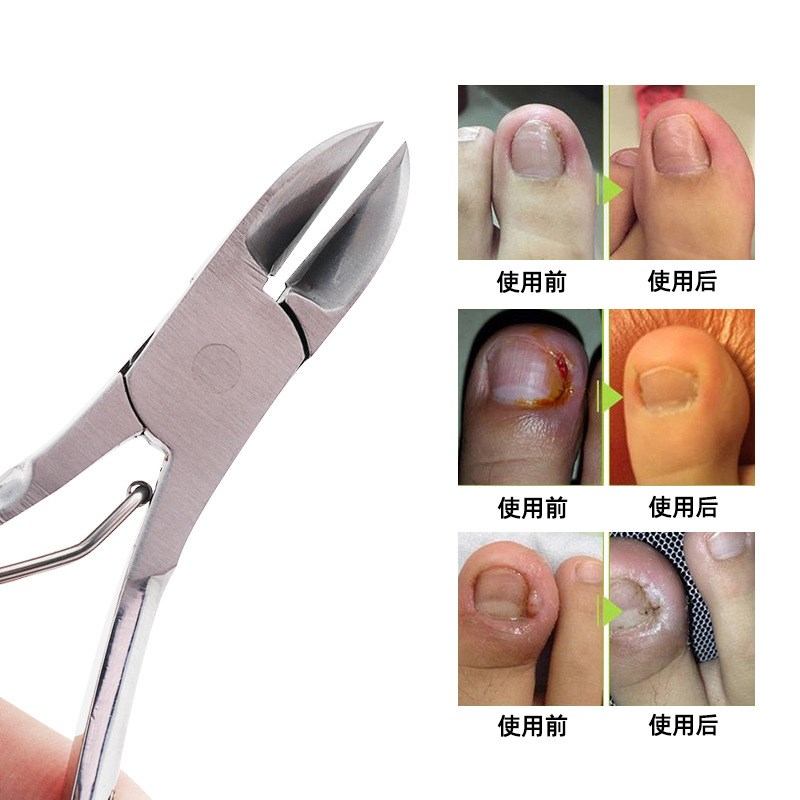 Stainless Steel Pattern Handle Cuticle Nipper Portable Dead