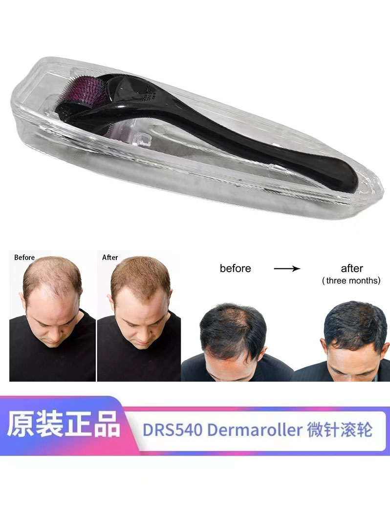 微针头皮导入滚针滚轮米诺帮助吸收头皮按摩仪 Hair Beard Roller 个人护理/保健/按摩器材 生发仪 原图主图