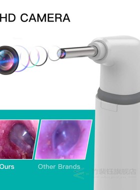 Wifi Ear Otoscope 3.9mm Smart Wireless Ear Visual Cleaning