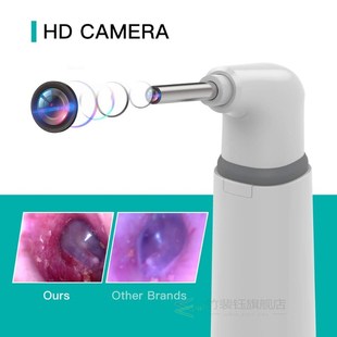 Wifi Ear Otoscope 3.9mm Smart Wireless Ear Visual Cleaning