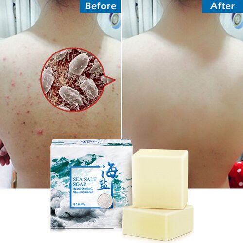 100g Sea Salt Soap Goat Milk Remove Acne Oil-Control Clean S