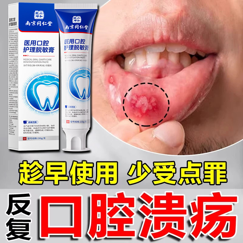 口腔溃疡专用牙膏成人儿童上火舌头溃疡牙龈出血肿疼痛含漱液凝胶