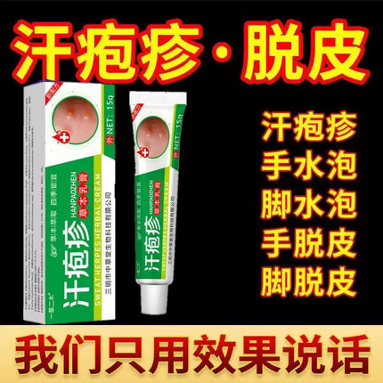 汗泡疱疹药膏手上起小水泡手痒汗状疱疹止痒汉状真菌感染专用软膏