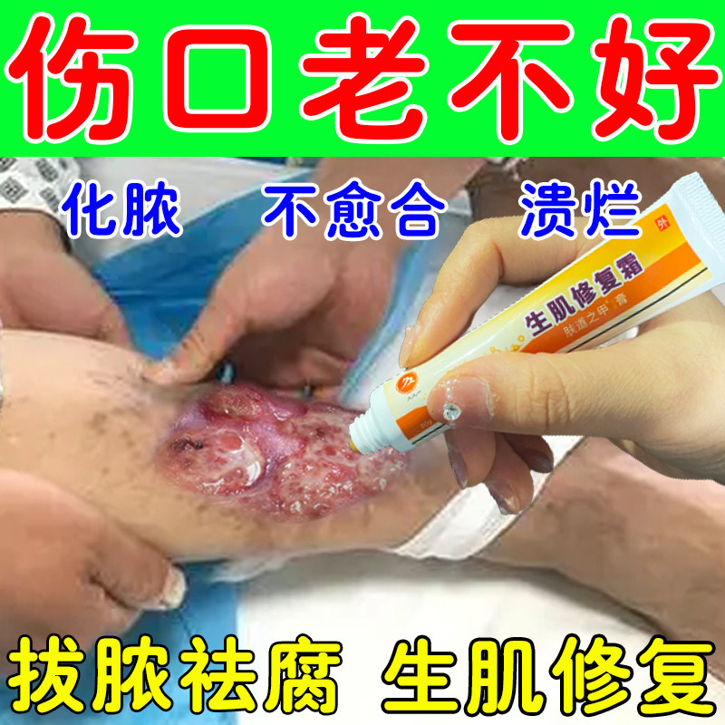 老烂腿伤口愈合快速结痂生肌霜