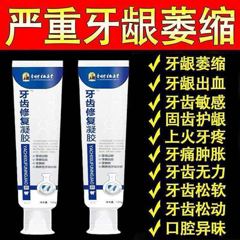 官方正品李时珍牙齿修复凝胶牙科分离剂牙龈萎缩牙齿松动牙龈出血