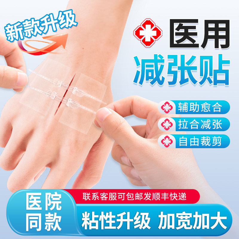 医用皮肤减张贴疤痕剖腹产伤口愈合贴儿童术后拉链张力贴减张器
