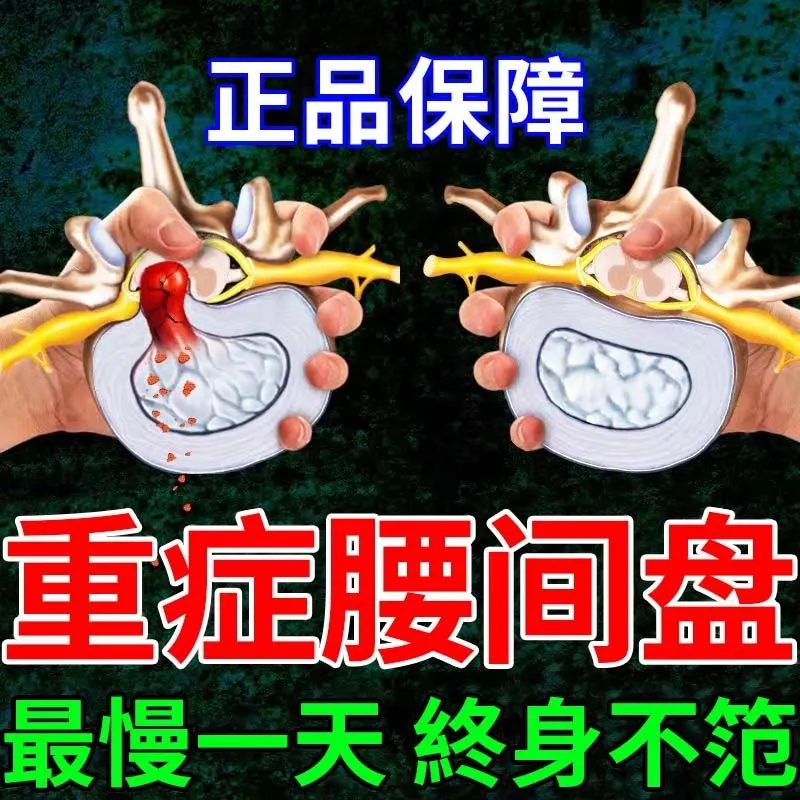 【一贴腰不疼】腰椎疼痛腰突膏贴坐骨...