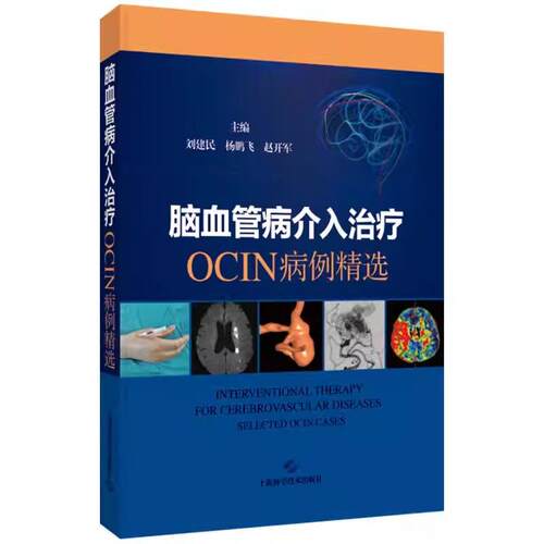 脑血管病介入治疗OCIN病例精选 刘建民 杨鹏飞 赵开军 主编上海科技9787547873052