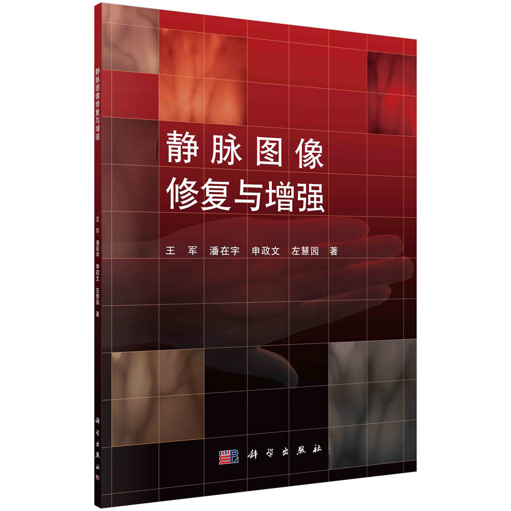 静脉图像修复与增强