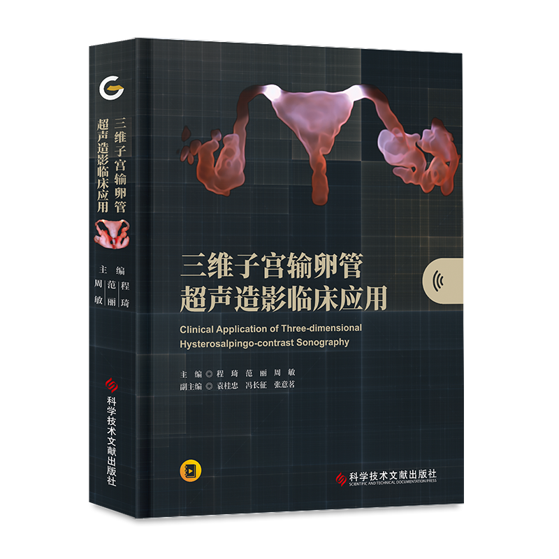 ys三维子宫输卵管超声造影临床