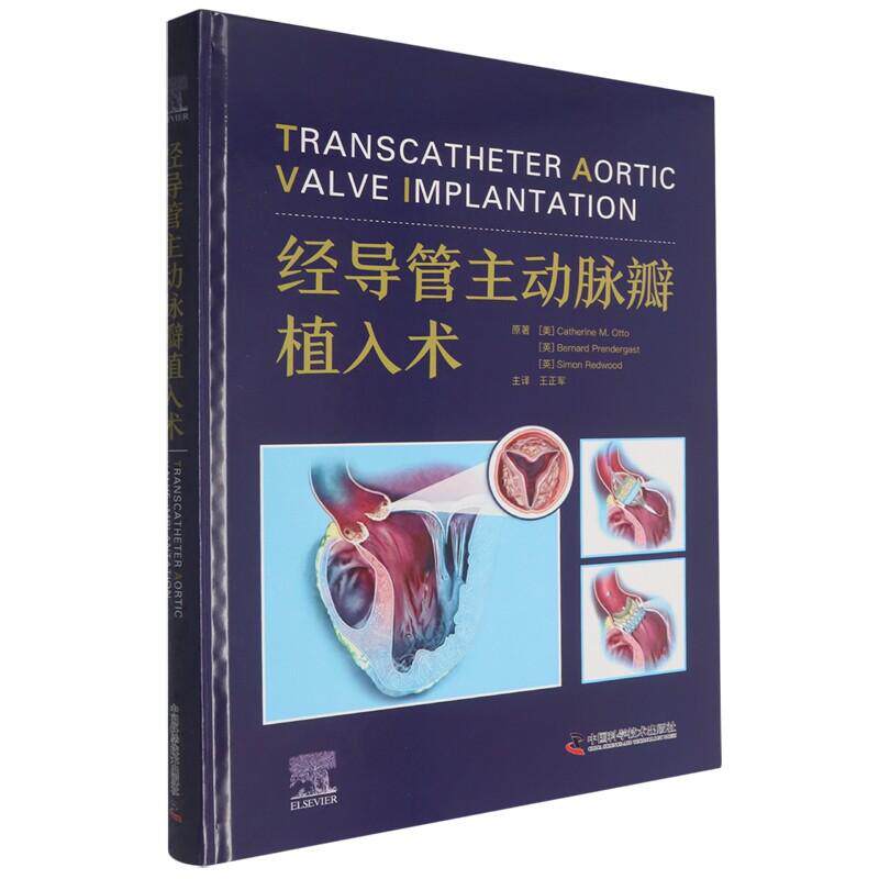 经导管主动脉瓣植入术9787523617489中国科学技术出版社