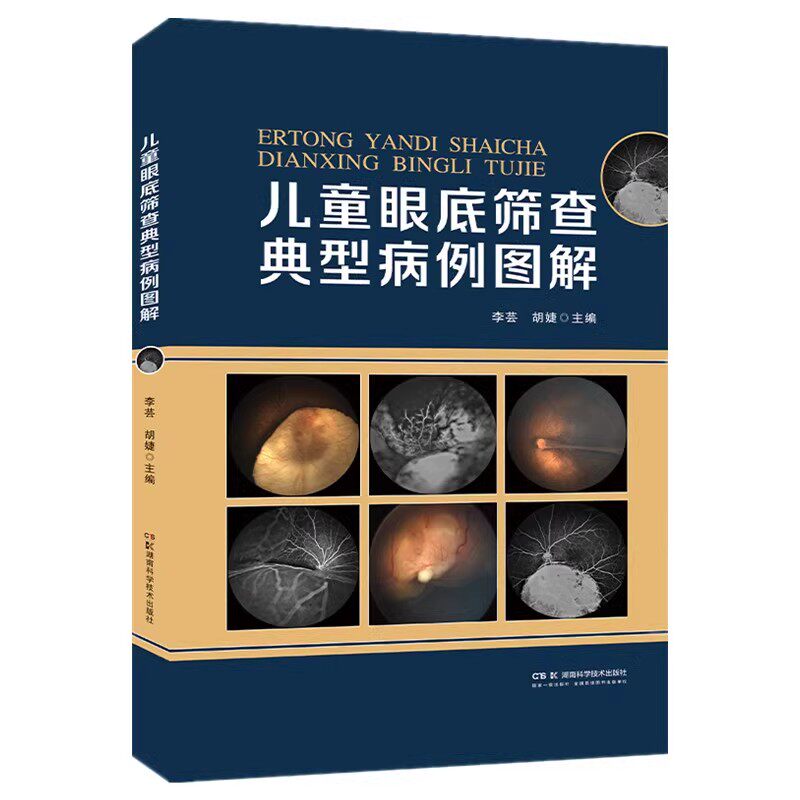 儿童眼底筛查典型病例图解 童眼病专家李芸教授  儿童眼底病例速查手册 鉴别诊断眼底病学 胡婕 湖南科学技术出版社9787571012434