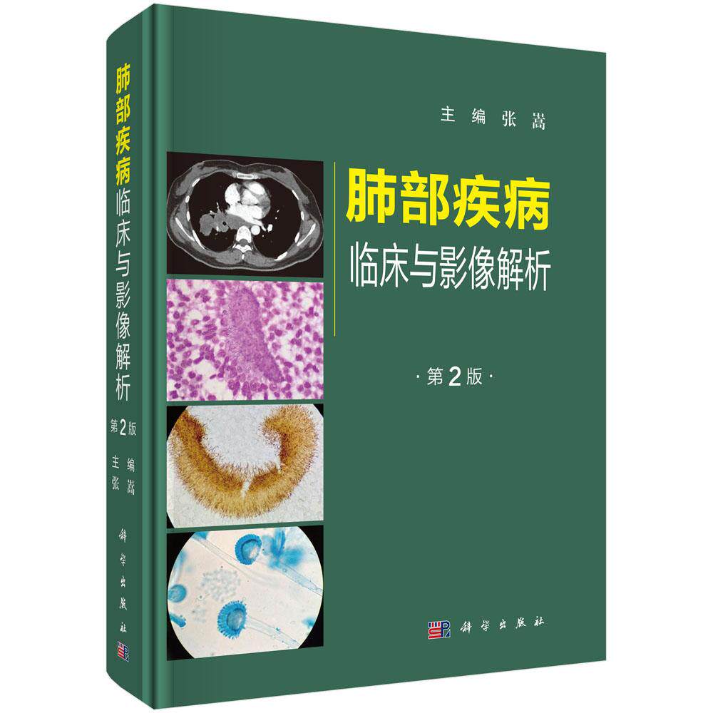 肺部疾病临床与影像解析（第二版）张嵩 肺部疾病临床影像特点影像鉴别诊断治疗病例分析9787030808776科学出版社
