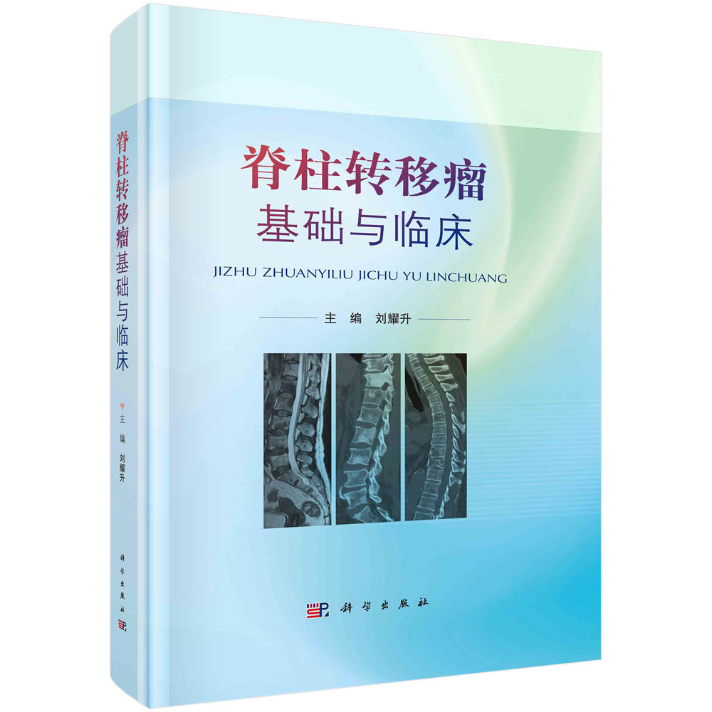 脊柱转移瘤基础与临床 骨转移机制 病理生理 基因表达 分子靶点 代谢标志物 免疫细胞调节 肱骨转移瘤 科学出版社 9787030729606