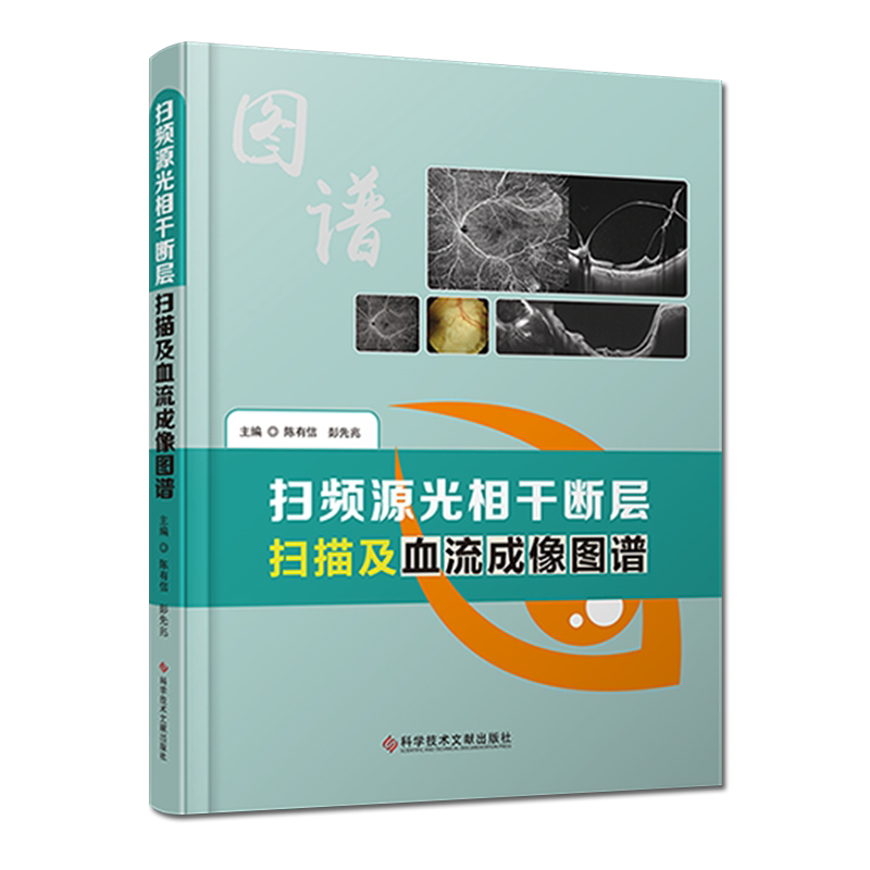 扫频源光相干断层扫描及血流成像图谱 眼病影像诊断图谱 临床医学书籍9787518973033科学技术文献出版社