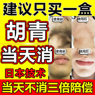胡青去除淡化男士胡子黑印络腮胡茬根软化抑制唇毛生长胡青脱毛膏