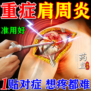 肩周炎专用贴膏肩膀酸痛抬不起胳膊治疗抬臂困难无力疼热敷膏药贴