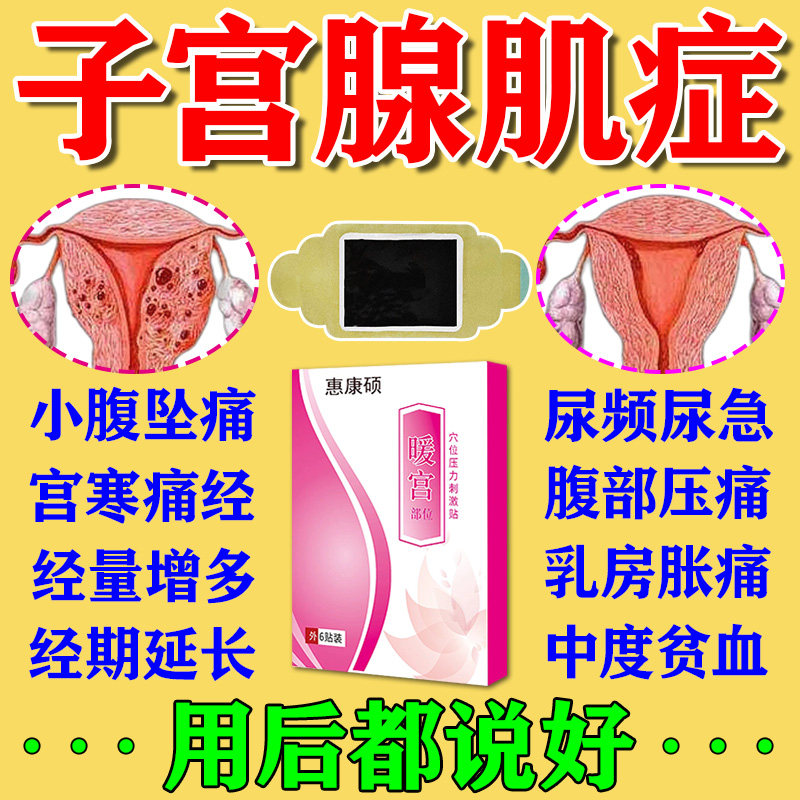 子宫腺肌症调理宫寒痛经经量多子宫内膜异位热敷中药贴巧克力N肿
