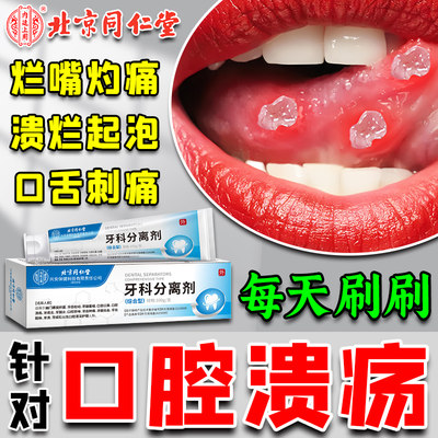 北京同仁堂口腔溃疡专用牙膏