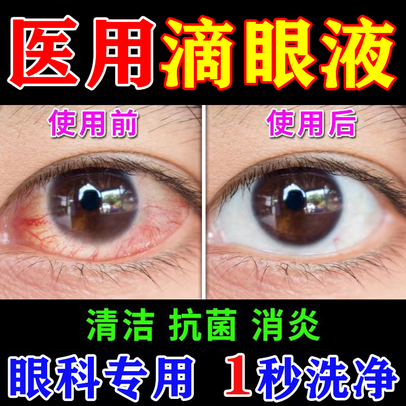 医用洗眼液清洁抗菌消炎缓解疲劳去红血丝去灰尘眼睛干涩护理液JZ