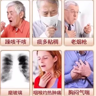 肺结节散节结茶消除清肺润肺养肺去磨玻璃结节特效中成特茶饮