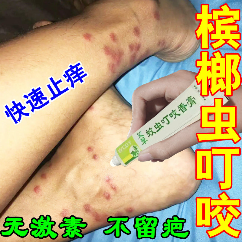 防槟榔虫叮咬喷雾三亚强力灭蠓虫驱蚊子腿上红疙瘩越抓越痒止痒膏