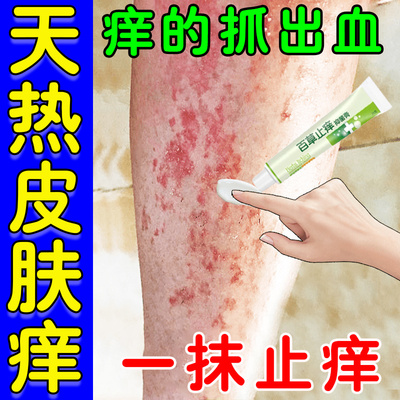 小腿痒用什么小腿皮肤痒起红疙瘩