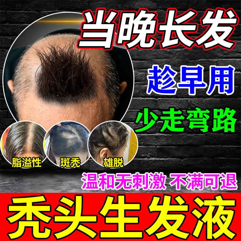 生发液激活毛囊增发密发长发剂防脱生发增发密发神器严重育发液