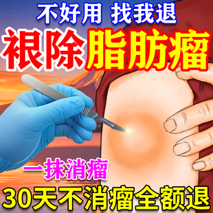 皮下脂肪瘤去除神器专用贴治疗皮脂腺囊肿鼓包硬块脂肪瘤消瘤膏药