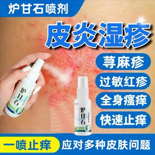 炉甘石止痒喷剂荨麻疹皮肤痒快速止痒喷雾