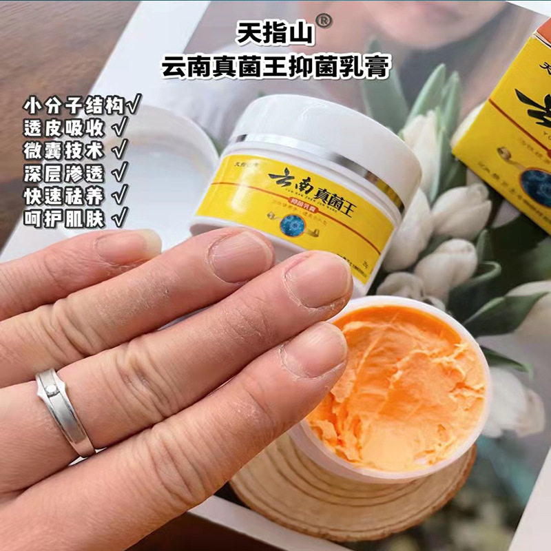 云南真菌王脚气偏方乳膏水泡脱皮膏外用根脚气药止痒感染