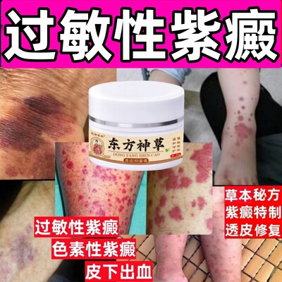 过敏性色素性紫癜药老年性紫癜皮炎瘀斑皮下出血淡化消除红点红斑