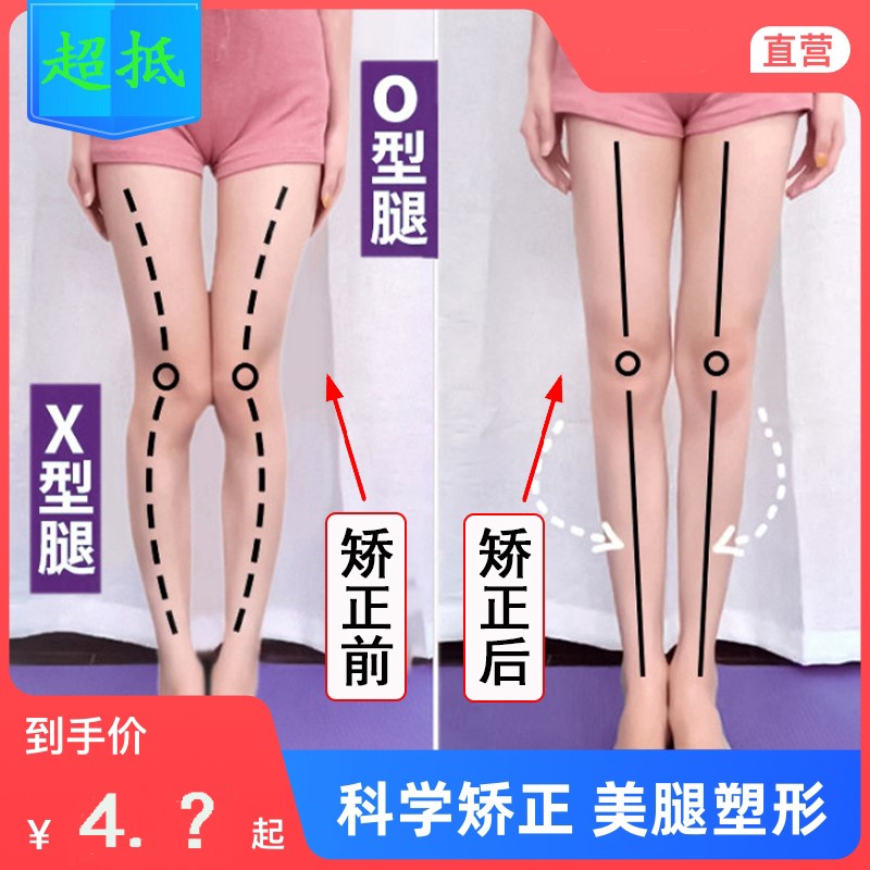 o型腿矫正神器纠正小腿外翻内八字脚xo绑腿带腿部儿童腿型x型直腿