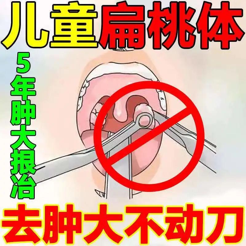 扁桃体肿大肥大理疗咽喉肿痛咳漱干痒有痰隐窝白点腺样体肥大止鼾