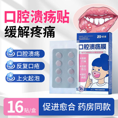 振德口腔溃疡膜舌头起泡口疮贴嘴巴上火舒缓成人儿童专用