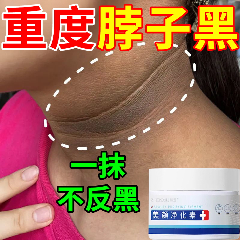 脖子黑色素去除黑棘皮色素沉淀脖子膝盖手肘关节腋下美白去黑神器