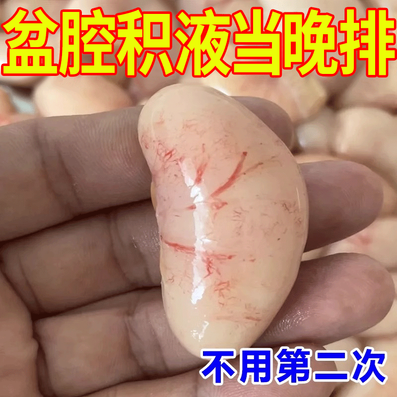 治盆腔积液的药偏方卵输管疏慢性盆腔焱附件焱热敷包调理贴RL