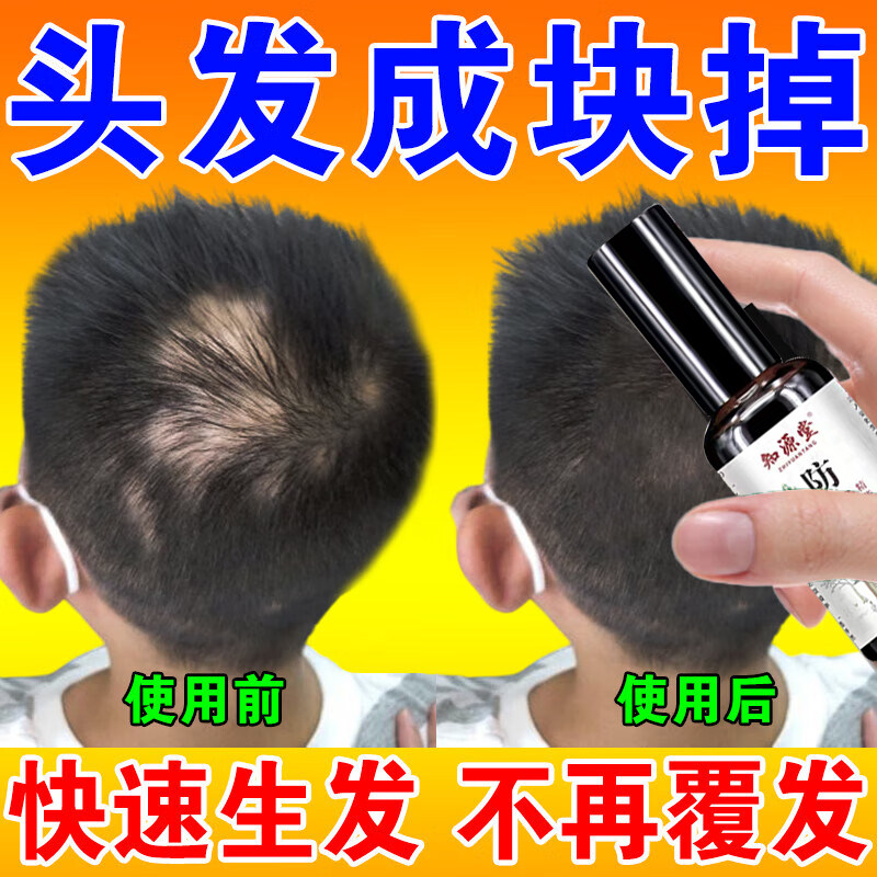 养血生发胶囊正品旗舰店唐威石药CF非斑秃药正品脱发脂溢性脱发