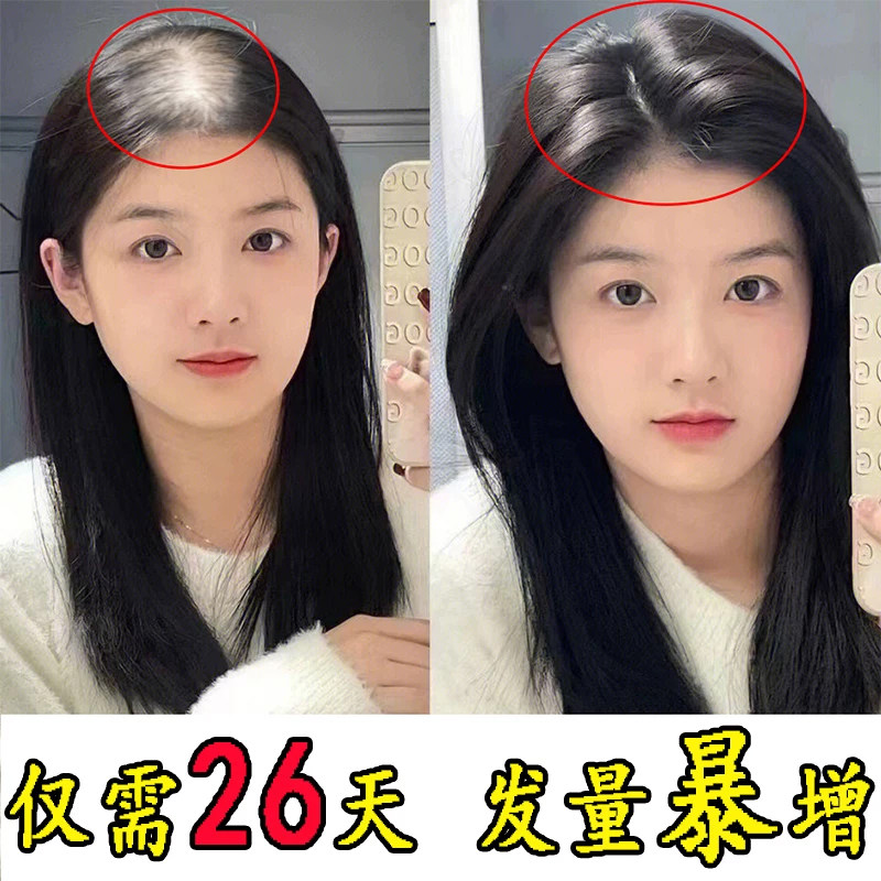 国华天麻首乌片中成药脱发白发滋阴补肾头晕头痛脂溢性脱发图片