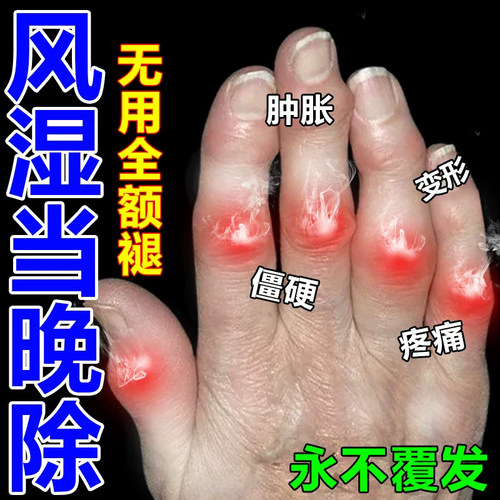 沈阳红药片红药片片活血止痛祛瘀跌打损伤风湿麻木肿痛