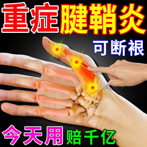 麝香壮骨止痛膏药贴膏贴膏药舒筋活血消炎腰椎间盘突出风湿