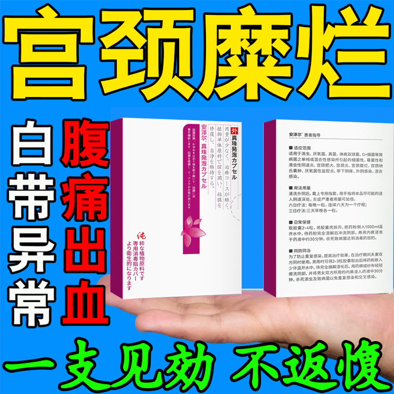 柏栀祛湿喷雾剂霉菌阴道妇科外阴私处瘙痒红肿破皮疼妇仁止痒乳膏