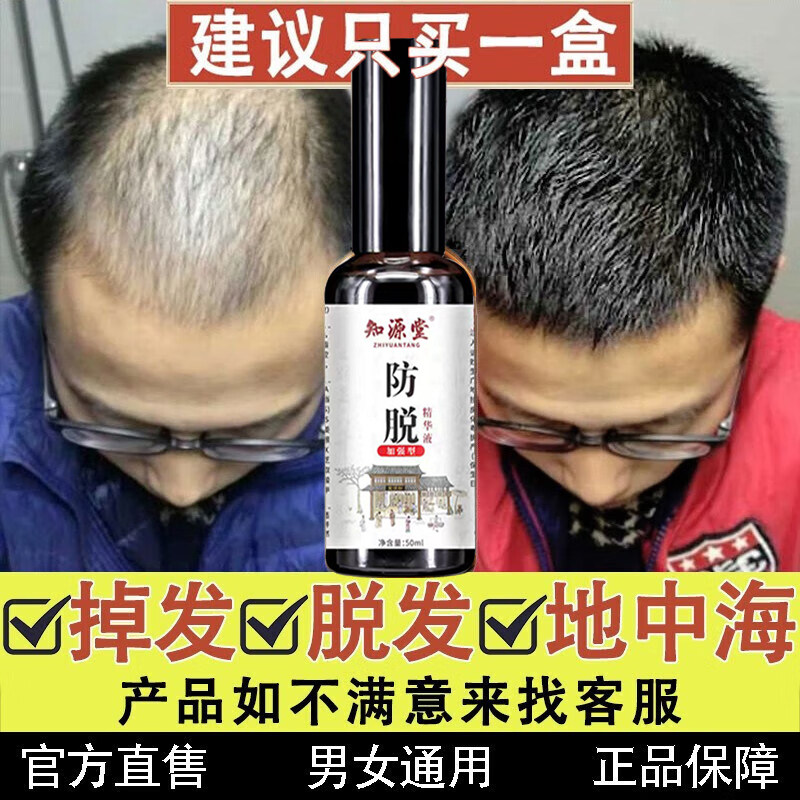 生发丸九芝堂填精滋肾黑发早白脱发治白发斑秃脱发cc图片