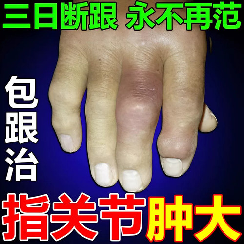 塞隆风湿关舒宝复方胶囊祛风除湿通络止痛骨痛