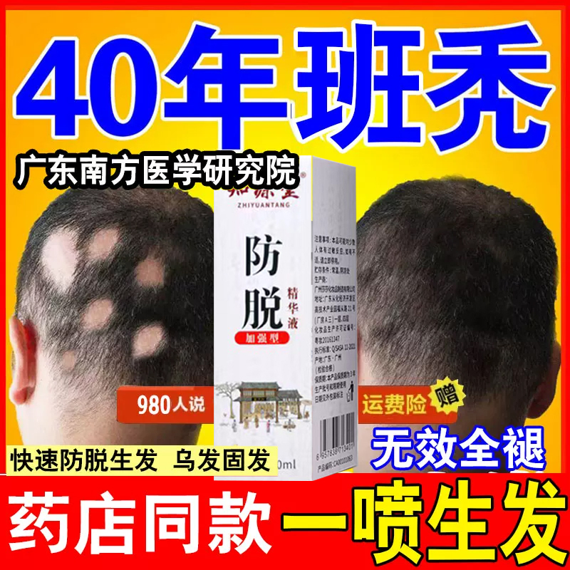 非那雄胺防脱发诚悦片雄激素发头发男性脱发秃发成人脂溢性脱发促