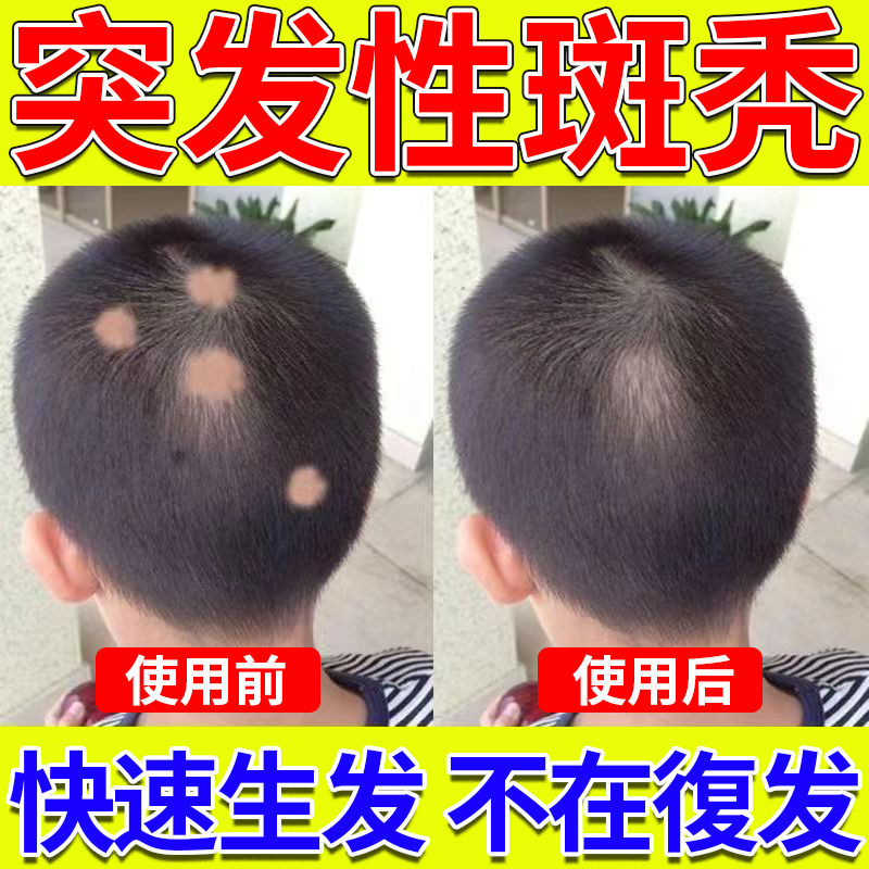 养血生发片国华 天麻首乌片滋阴补肾脱发白发耳呜神经性头痛图片