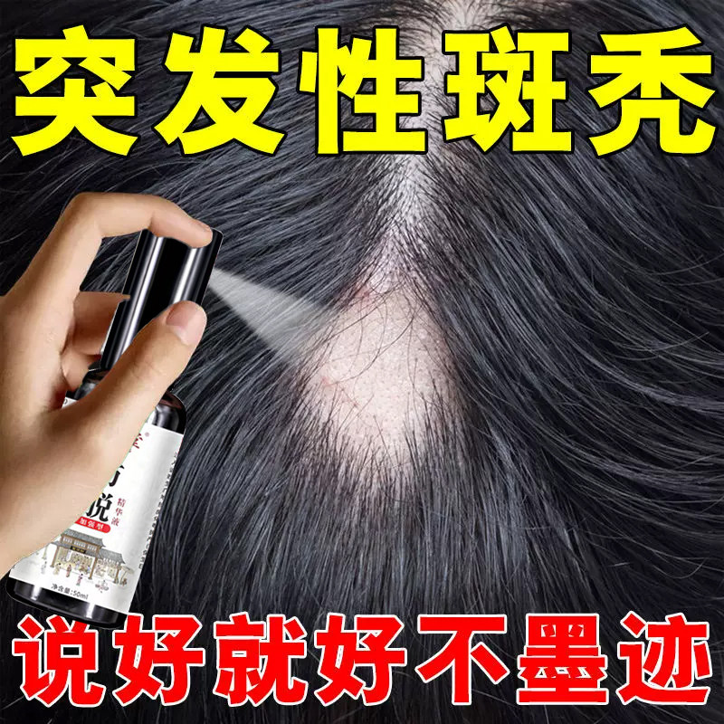 养血生发片国华 天麻首乌片 脂溢性脱发 养血生发 白发脱发图片