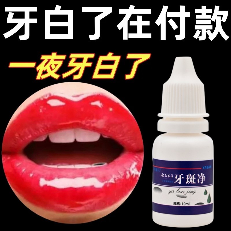 洗牙药水牙斑净速效去黄除烟渍牙齿美白速效黄牙神器牙渍一擦即除