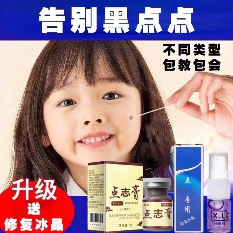 点痣膏无痕正品去志痣膏无痕药水脸部祛斑痦子取去除黑痣专用神器