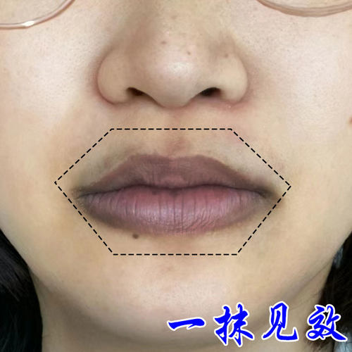 嘴角发黑改善唇周黑色素沉淀唇膏